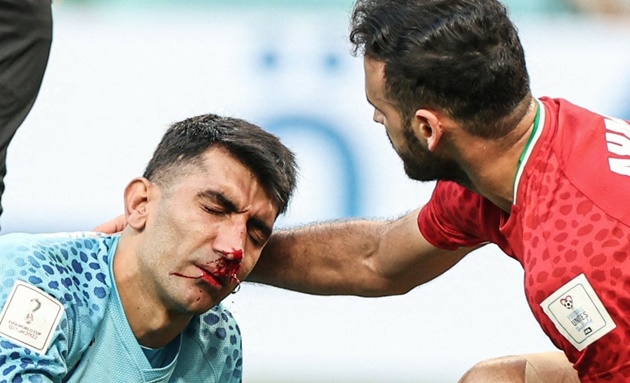 Máu chảy trên mặt của thủ môn Iran