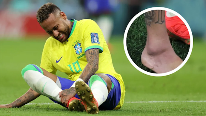 Neymar Jr gặp chấn thương mắt cá chân